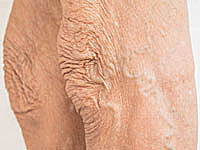 老人の脚の皮膚の画像